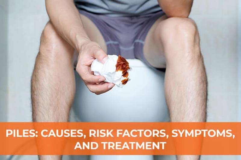 Infographic showing causes of piles like constipation and lifestyle habits