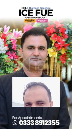 Dental Smile Makeover Before After — AlKhaleej Clinics Karachi