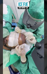 Video 8