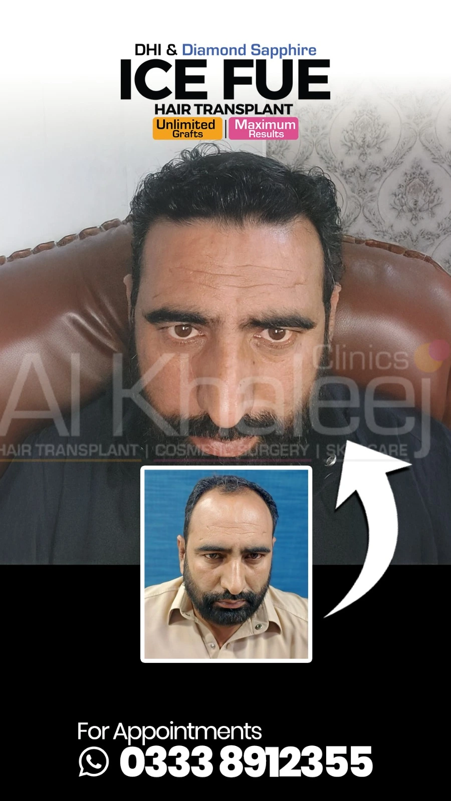 Stem Cell Autism Treatment Result — AlKhaleej Clinics Karachi