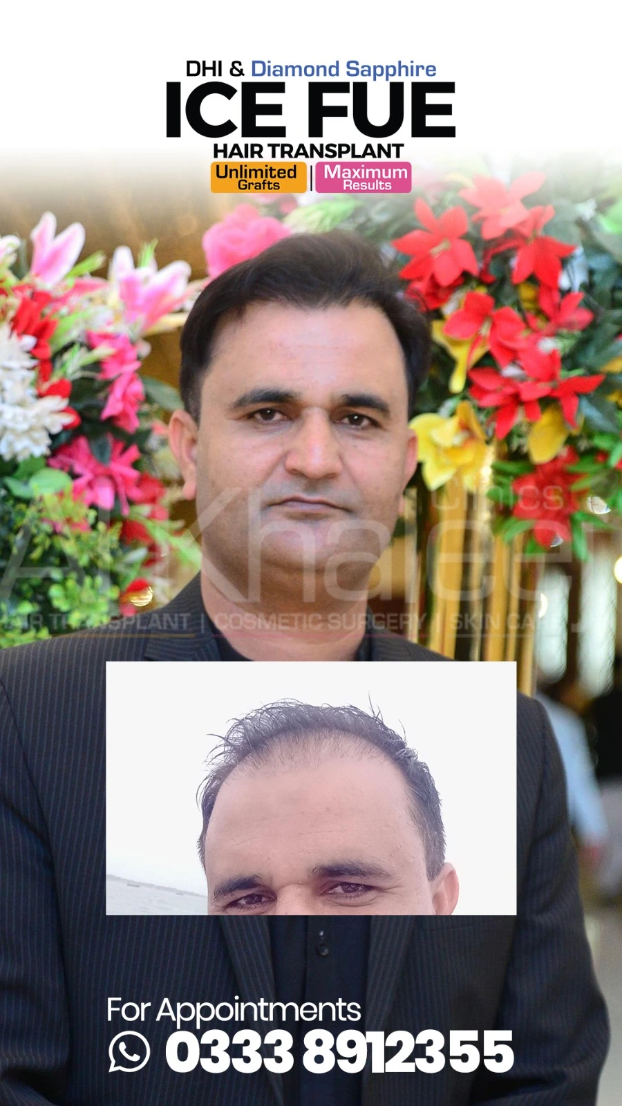 Dental Smile Makeover Before After — AlKhaleej Clinics Karachi