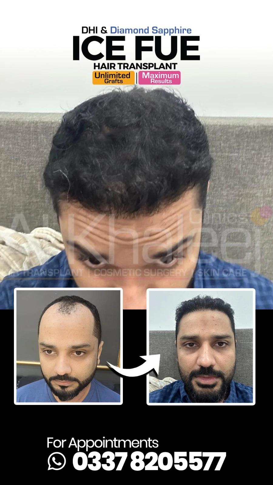 Weight Loss Body Transformation — AlKhaleej Clinics Karachi